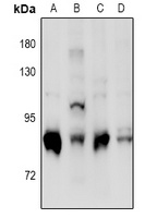 PKC delta (Phospho-S664) Rabbit Polyclonal Antibody