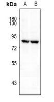 FRS2 (Phospho-Y196) Rabbit Polyclonal Antibody