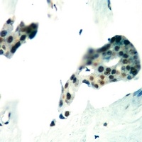 CD91 (Phospho-S4520) Antibody