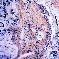 Vimentin (Phospho-S39) Rabbit Polyclonal Antibody