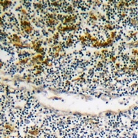 BIK (Phospho-S35) Antibody