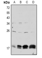 Claudin 4 (Phospho-Y208) Rabbit Polyclonal Antibody