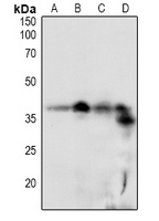 DSCR1 (Phospho-S108) Rabbit Polyclonal Antibody
