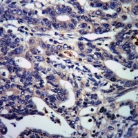 DSCR1 (Phospho-S108) Rabbit Polyclonal Antibody