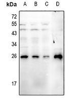 RGS19 (Phospho-S151) Rabbit Polyclonal Antibody