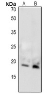 MBP (Phospho-T232) Antibody