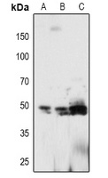 PTP1B (Phospho-Y66) Rabbit Polyclonal Antibody