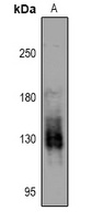 PKN1/2 (Phospho-T774/816) Antibody