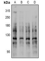 E Cadherin (Phospho-S844) Rabbit Polyclonal Antibody