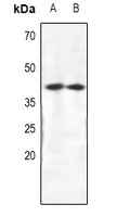 CRKL Rabbit Polyclonal Antibody