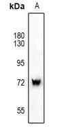 SYK Rabbit Polyclonal Antibody
