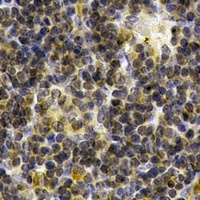SYK Rabbit Polyclonal Antibody