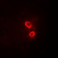 SYK Rabbit Polyclonal Antibody