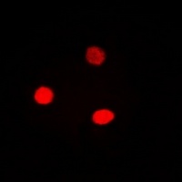 Cyclin E1 Rabbit Polyclonal Antibody