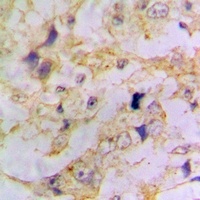 Doublecortin Rabbit Polyclonal Antibody