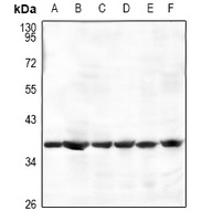 AMPK beta 1 Rabbit Polyclonal Antibody
