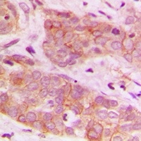 AMPK beta 1 Rabbit Polyclonal Antibody