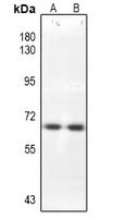 CDC25B Rabbit Polyclonal Antibody