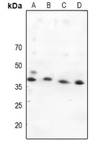 MKK4 Rabbit Polyclonal Antibody