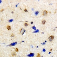 MKK4 Rabbit Polyclonal Antibody