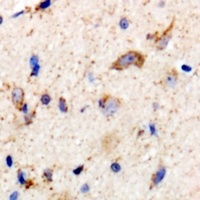 CD91 Rabbit Polyclonal Antibody