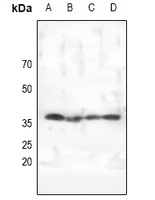 AMPK gamma 1/2/3 Rabbit Polyclonal Antibody