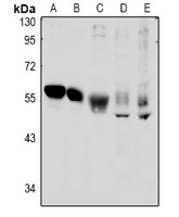 TSG101 Rabbit Polyclonal Antibody