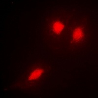 TSG101 Rabbit Polyclonal Antibody