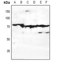 EMR3 Rabbit Polyclonal Antibody