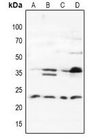 MAD2L1BP Rabbit Polyclonal Antibody