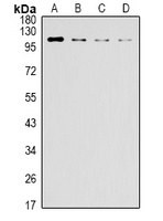 IRE1 Mouse Monoclonal Antibody