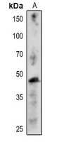 CFBP1 Rabbit Polyclonal Antibody