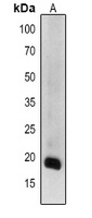 GDH1/2/3 Rabbit Polyclonal Antibody