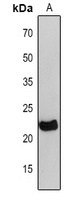 petC Rabbit Polyclonal Antibody