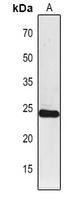 PSAF Rabbit Polyclonal Antibody