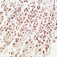 PS2 Rabbit Polyclonal Antibody
