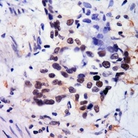 BMAL1 (Acetyl-K538) Rabbit Polyclonal Antibody