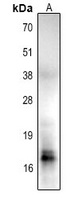 Histone H2B (Acetyl-K85) Rabbit Polyclonal Antibody
