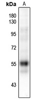 RUNX1 (Phospho-S249) Rabbit Polyclonal Antibody