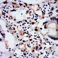 RUNX1 (Phospho-S249) Rabbit Polyclonal Antibody