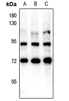 FOXO1/3 (Phospho-S322+S325/pS318+S321) Rabbit Polyclonal Antibody