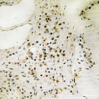 FOXO1/3 (Phospho-S322+S325/pS318+S321) Rabbit Polyclonal Antibody