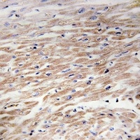 CD117 (Phospho-Y936) Rabbit Polyclonal Antibody