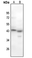 MYOD1 (Phospho-S200) Rabbit Polyclonal Antibody