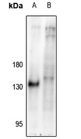 NFAT1 (Phospho-S326) Rabbit Polyclonal Antibody
