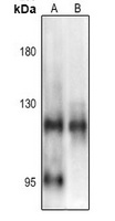 NF-kappaB p105 (Phospho-S903) Rabbit Polyclonal Antibody