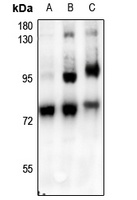 c-RAF (Phospho-S621) Rabbit Polyclonal Antibody