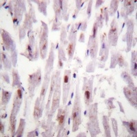 c-RAF (Phospho-S621) Rabbit Polyclonal Antibody