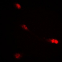 c-RAF (Phospho-S621) Rabbit Polyclonal Antibody