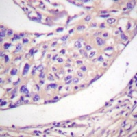 Thymidine Kinase 1 (Phospho-S13) Rabbit Polyclonal Antibody